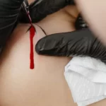 How to get excess tattoo ink off skin