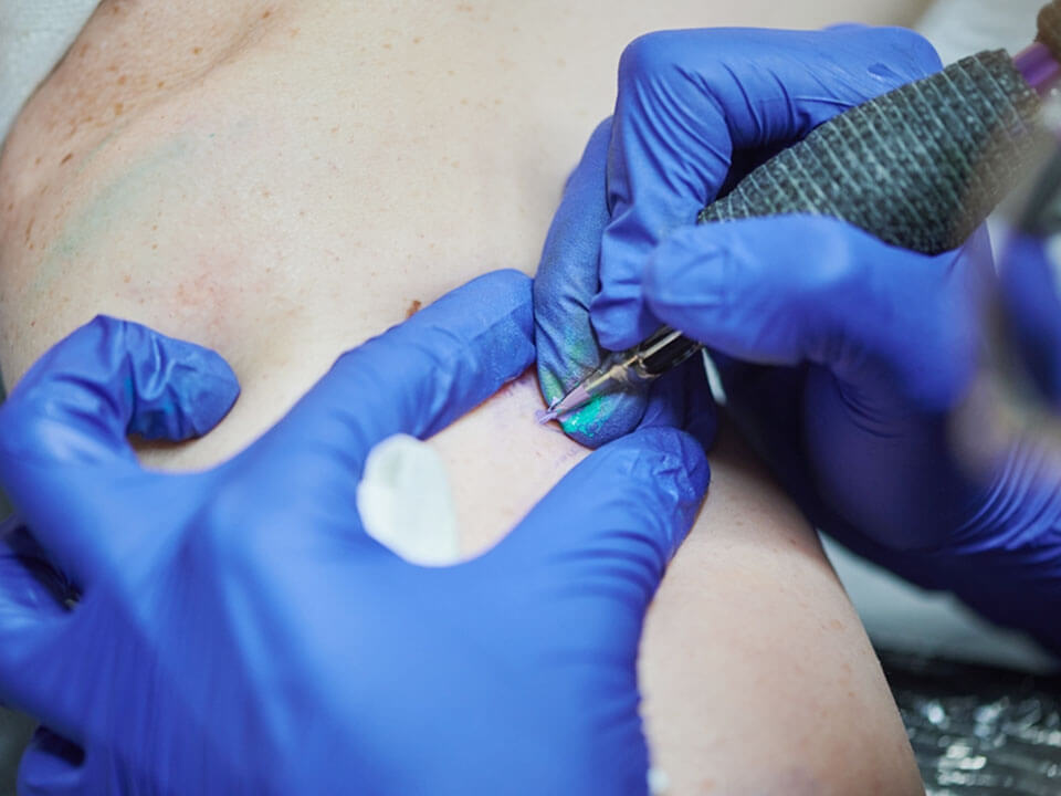 How Will a new tattoo affect surgery