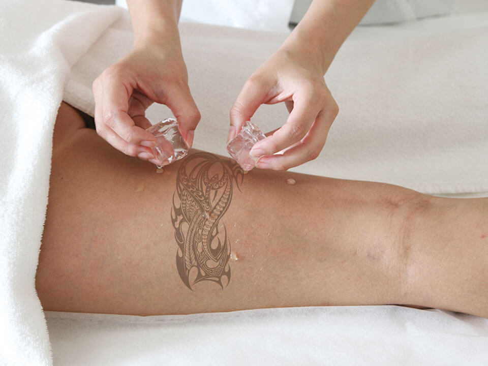 Never apply ice directly