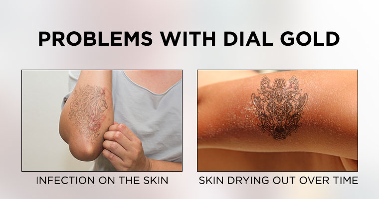 Problems with Dial Gold