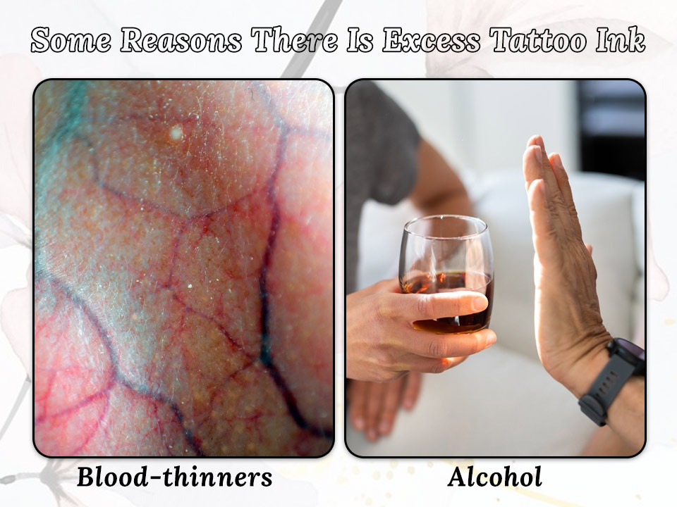 Some other reasons there is excess tattoo ink