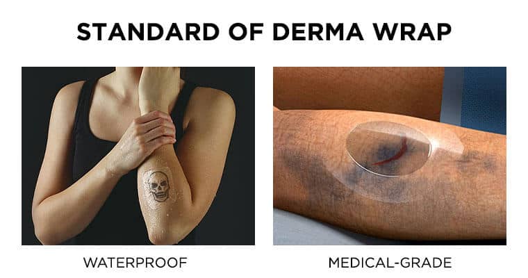 The Gold Standard of Derma Wrap Saniderm