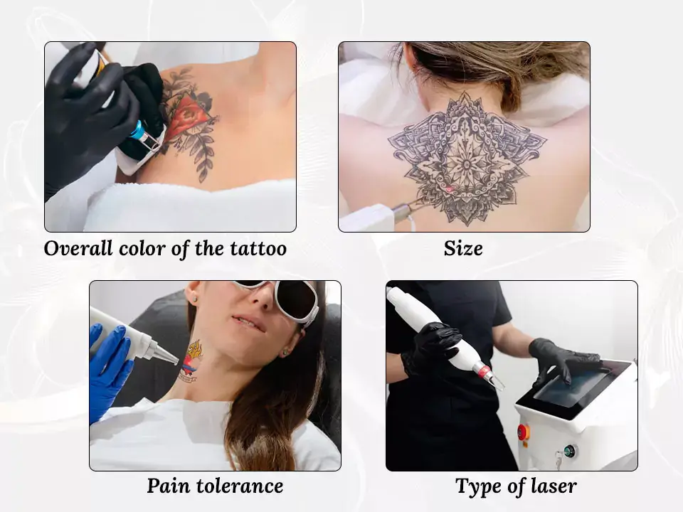 How Long does tattoo removal take