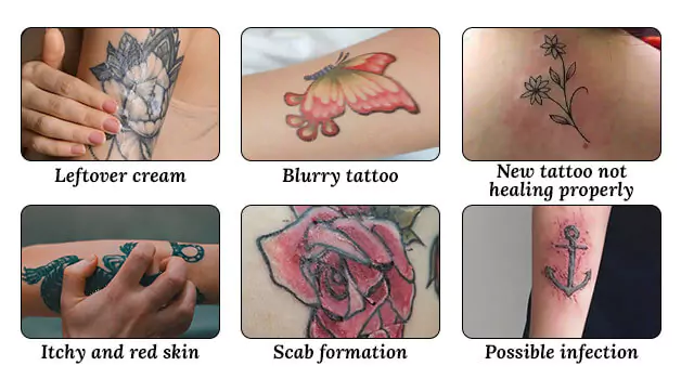 Signs that your tattoo is over-moisturized