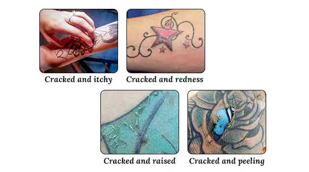 Types of cracked tattoos