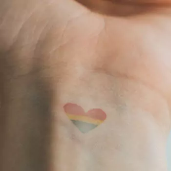 Poor tattoo aftercare