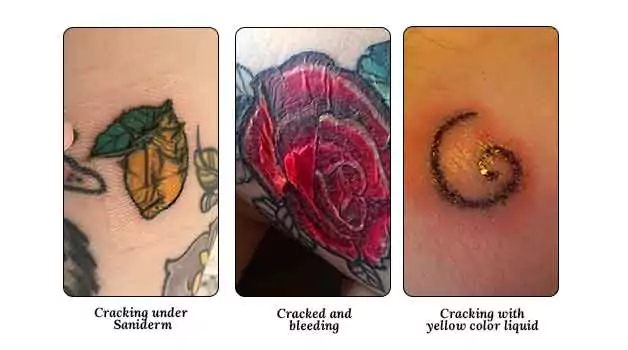 Types of cracked tattoos