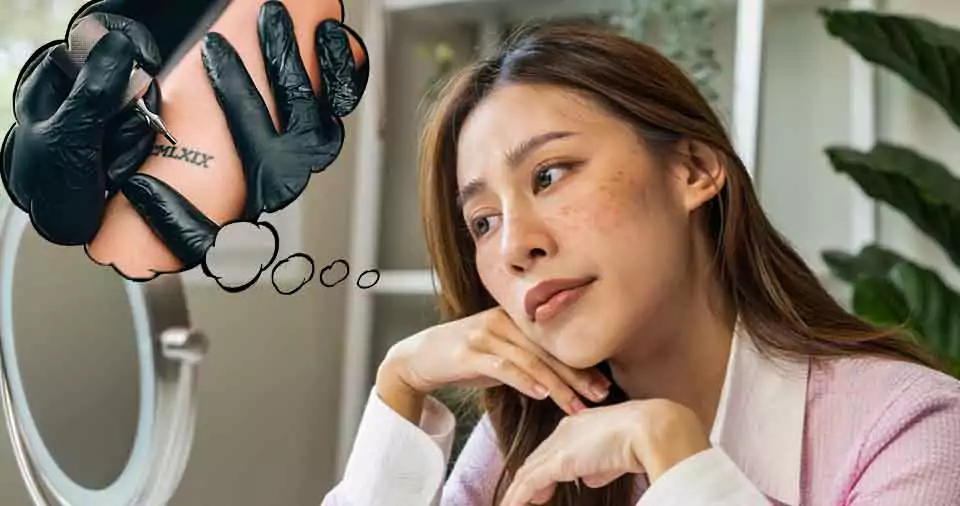 Can you get a tattoo on accutane