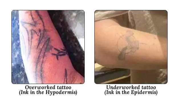 Causes of Tattoo Scab Containing Ink