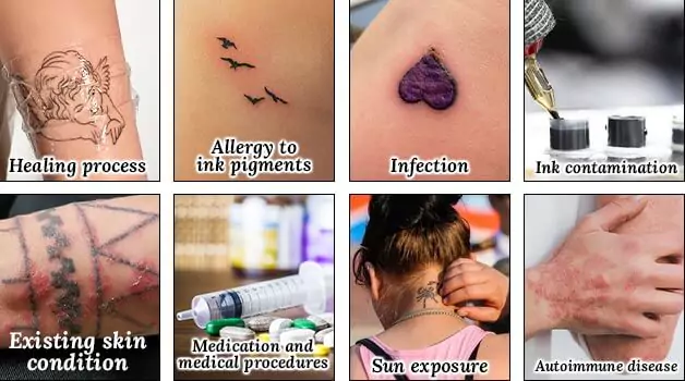 Causes of itchy tattoos