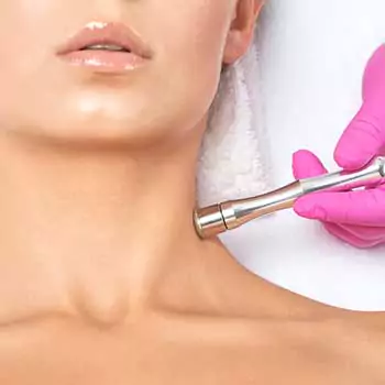 Dermabrasion