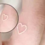 Do white tattoos turn yellow