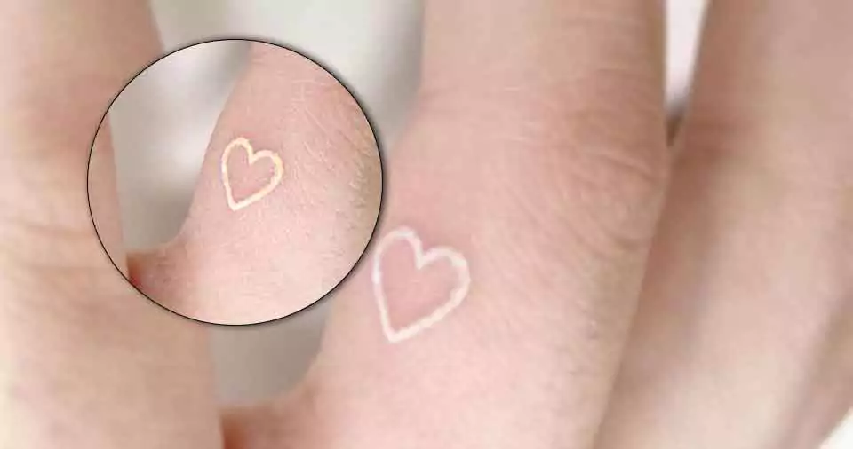 Do white tattoos turn yellow