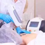 How to become a tattoo removalist