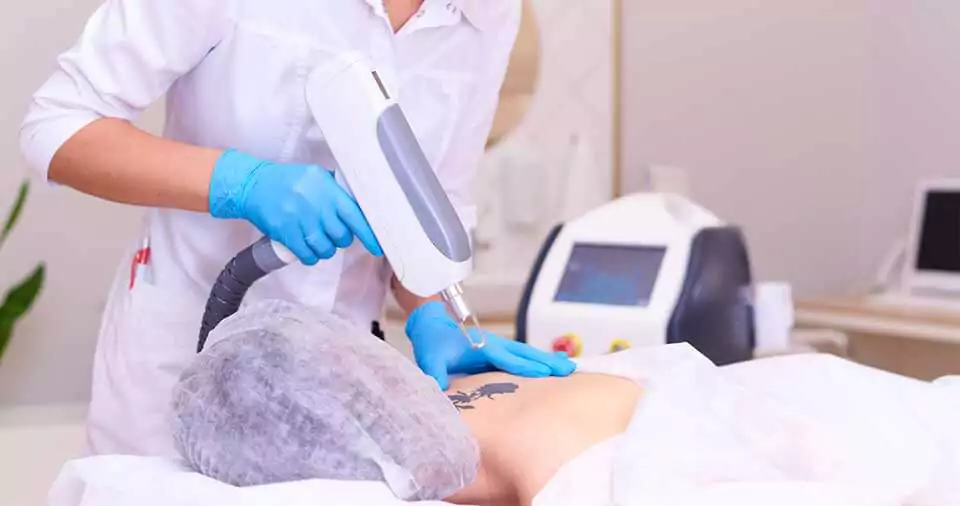 How to become a tattoo removalist