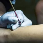 How to get a stick and poke off