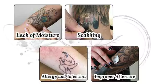 Major reasons for tattoo cracking