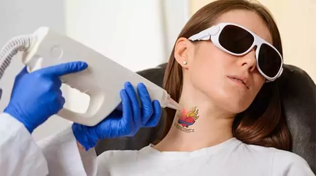 Responsibilities of a tattoo removalist