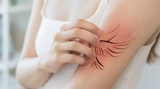 Science behind tattoo itching