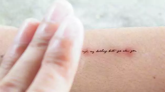 So why does slapping help with tattoo itch