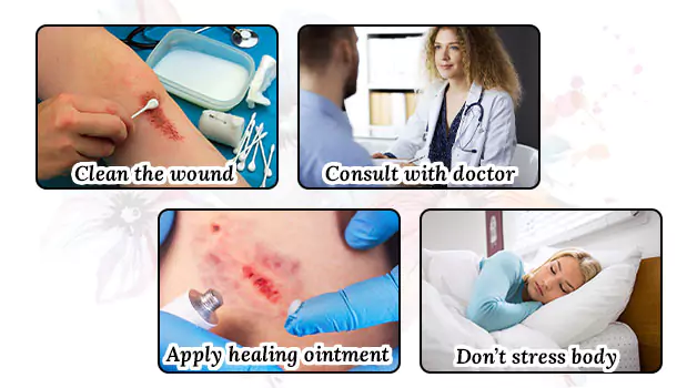 Taking care of a cut on a tattoo