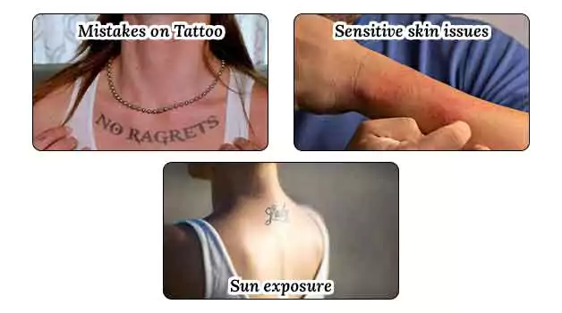 Tattoo touch-ups Who needs it