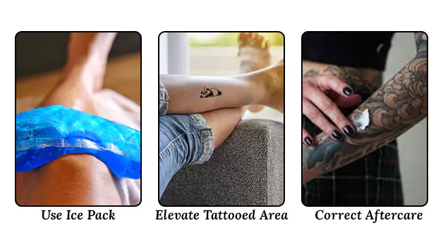 Ways to deal with a burning tattoo