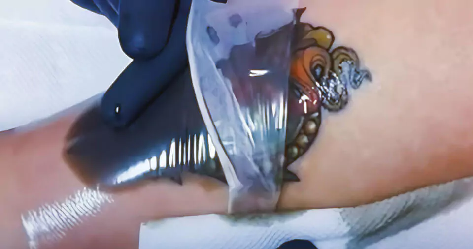 What is an Ink Sack Tattoo