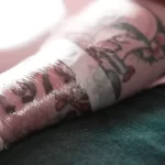 how-long-to-keep-bandage-on-after-laser-tattoo-removal