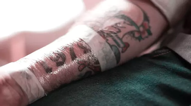how-long-to-keep-bandage-on-after-laser-tattoo-removal