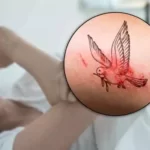 Accidentally scratched my tattoo in my sleep