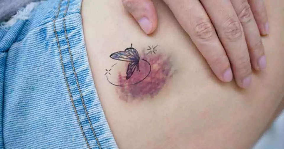 Can you tattoo over a bruise