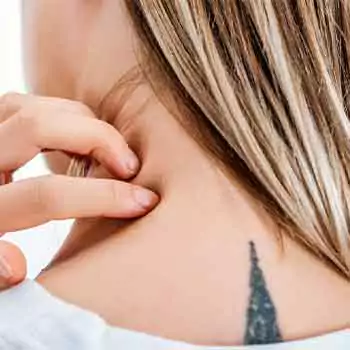 Difficult to notice allergic sing