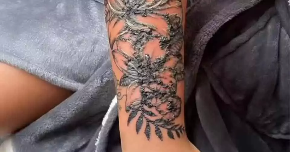 Does tattoo bubbling go away