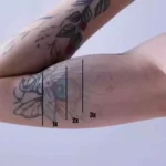 How Many sessions does it take to remove a tattoo