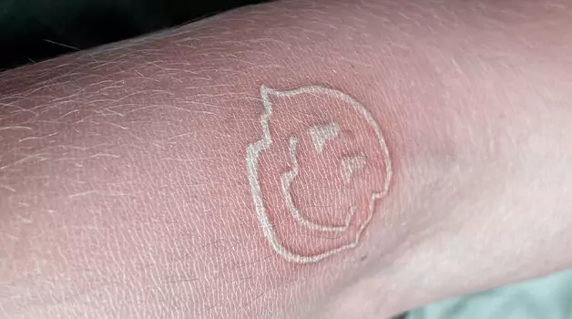 How does tattoo turn white