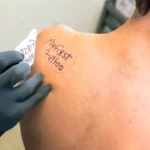 How to remove tattoo stencil