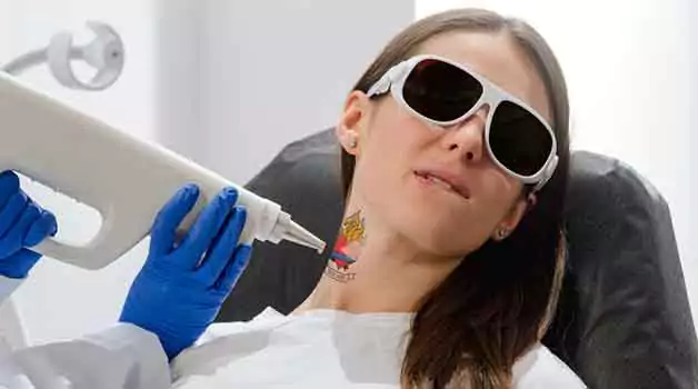 Pain related to tattoo removal