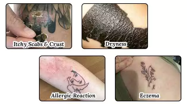 Reasons why you May scratch your tattoo in sleep