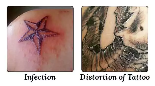 Risk of tattoo bubble