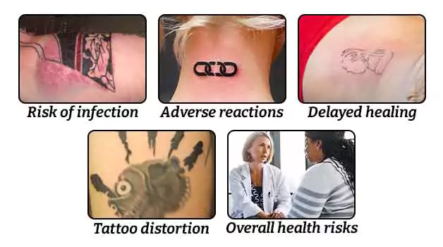 5 Risks of getting a tattoo without waiting after laparoscopic surgery
