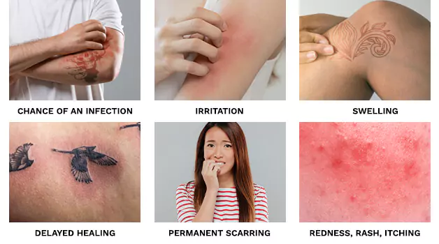 6 Reasons why you should not put sunscreen on a new tattoo