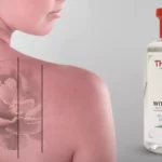 Does witch Hazel fade tattoos