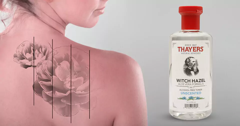 Does witch Hazel fade tattoos