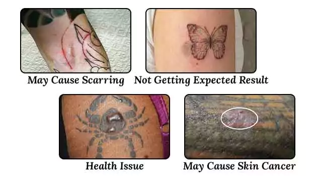 Reasons why you should not get a tattoo over a birthmark