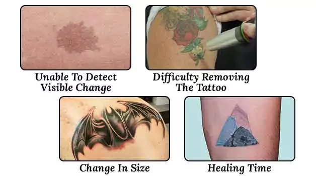 Reasons why you should not get a tattoo over a birthmark