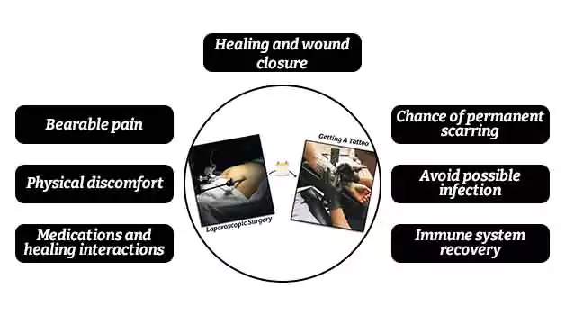 Reasons you should wait to get a tattoo after laparoscopic surgery