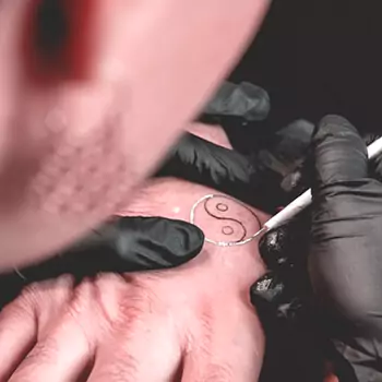 Repetitive needle poking