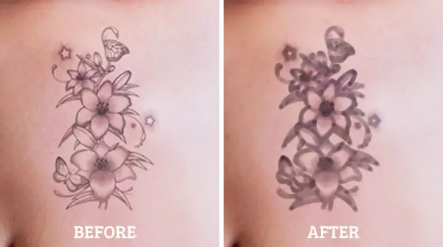 Tattoo lines thicker after healing