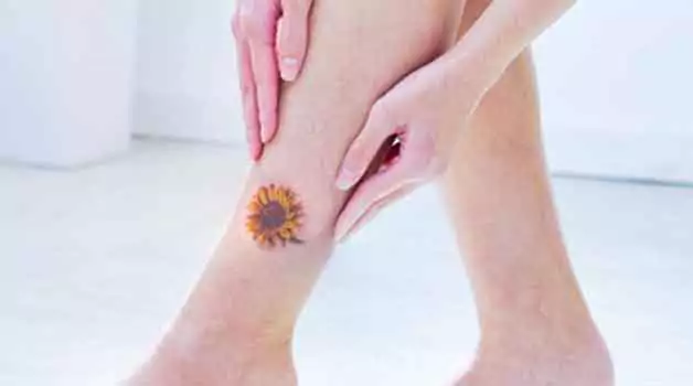 Tattooing over a birthmark